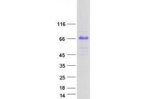 TRIM55 Protein (Transcript Variant 3) (Myc-DYKDDDDK Tag)