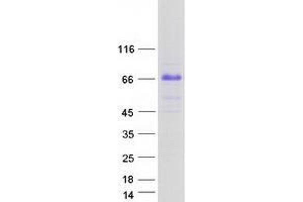 TRIM55 Protein (Transcript Variant 3) (Myc-DYKDDDDK Tag)
