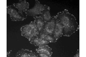 Immunofluorescent staining of A549 cells. (FAK antibody  (pTyr397))