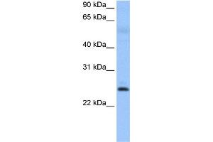 WB Suggested Anti-ROPN1B Antibody Titration: 0. (ROPN1B antibody  (N-Term))