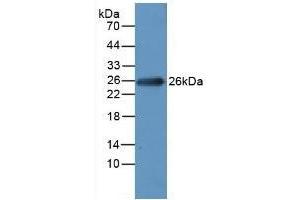 Detection of MYL1 in Rat Heart Tissue using Polyclonal Antibody to Myosin Light Chain 1 (MYL1) (MYL1 antibody  (AA 3-142))