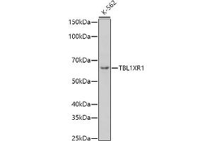 Western blot analysis of extracts of K-562 cells, using TBL1XR1 antibody (ABIN6132717, ABIN6148893, ABIN6148895 and ABIN6217436) at 1:1000 dilution. (TBL1XR1 antibody  (AA 1-180))