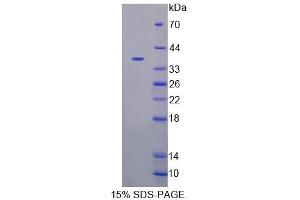 SDS-PAGE analysis of Mouse CASQ2 Protein. (CASQ2 Protein)
