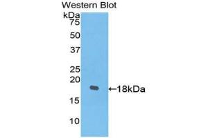 Western blot analysis of the recombinant protein. (PDGFC antibody  (AA 235-345))