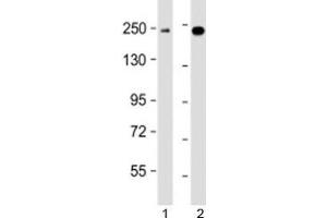 Western blot testing of human 1) K562 and 2) MCF7 cell lysate with XRN1 antibody at 1:2000. (XRN1 antibody  (AA 1455-1706))