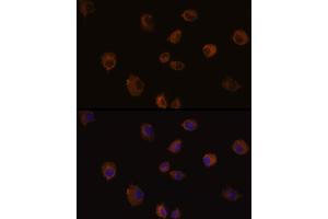 Immunofluorescence analysis of C6 cells using MMP13 Rabbit pAb (ABIN6130559, ABIN6143903, ABIN6143904 and ABIN6215450) at dilution of 1:100 (40x lens). (MMP13 antibody  (AA 262-471))