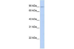 XYLT2 antibody used at 1 ug/ml to detect target protein. (XYLT2 antibody  (C-Term))