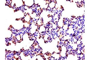 Paraformaldehyde-fixed, paraffin embedded rat lung tissue, Antigen retrieval by boiling in sodium citrate buffer(pH6) for 15min, Block endogenous peroxidase by 3% hydrogen peroxide for 30 minutes, Blocking buffer (normal goat serum) at 37°C for 20min, Antibody incubation with Rabbit Anti-C2orf89 Polyclonal Antibody, Unconjugated  at 1:500 overnight at 4°C, followed by a conjugated secondary and DAB staining (TRABD2A antibody)