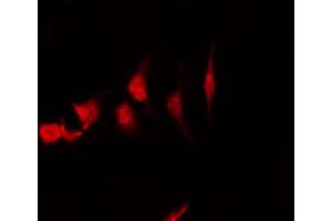 ABIN6266538 staining HepG2 by IF/ICC. (FGFR1OP antibody  (C-Term))
