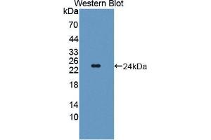 Western blot analysis of the recombinant protein. (TWSG1 antibody  (AA 26-223))