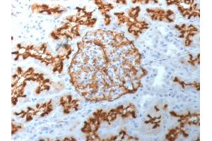 Formalin-fixed, paraffin-embedded human Kidney stained with CD10 Mouse Monoclonal Antibody (MME/1892). (MME antibody  (AA 297-483))