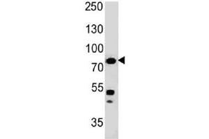 Western blot testing of human HT29 cell lysate with Moesin antibody (clone MSN/491).