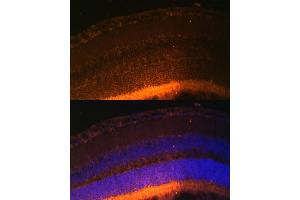 Immunofluorescence analysis of mouse retina using GRK1 Polyclonal Antibody (ABIN6134352, ABIN6141414 and ABIN7101798) at dilution of 1:100 (40x lens). (GRK1 antibody  (AA 1-160))
