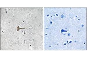 Immunohistochemistry analysis of paraffin-embedded human brain tissue, using Kv4. (KCND2 antibody  (AA 581-630))