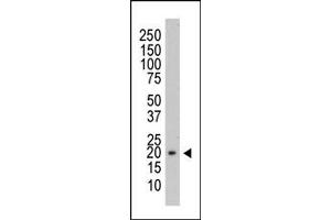Western Blotting (WB) image for anti-Protein Tyrosine Phosphatase Type IVA, Member 3 (PTP4A3) antibody (ABIN356421)