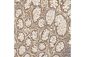 IHC analysis of Citrin/SLC25A13 using anti-Citrin/SLC25A13 antibody (ABIN7599512). (slc25a13 antibody  (AA 1-643))