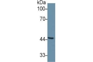 Western Blotting (WB) image for serpin Peptidase Inhibitor, Clade A (Alpha-1 Antiproteinase, Antitrypsin), Member 6 (SERPINA6) ELISA Kit (ABIN6574263)