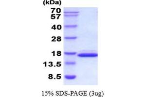 SDS-PAGE (SDS) image for Lectin, Galactoside-Binding, Soluble, 2 (LGALS2) (AA 1-130) (Active) protein (His tag) (ABIN6387705) (Galectin 2 Protein (AA 1-130) (His tag))
