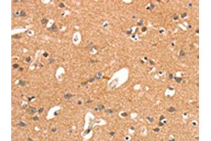 The image on the left is immunohistochemistry of paraffin-embedded Human brain tissue using ABIN7189890(ARHGAP4 Antibody) at dilution 1/25, on the right is treated with synthetic peptide. (ARHGAP4 antibody)