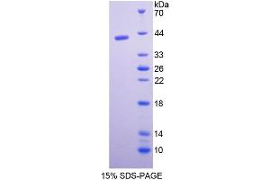 SDS-PAGE analysis of Rat Pepsinogen C Protein. (PGC Protein)