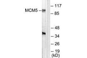 Western blot analysis of extracts from HepG2 cells, using MCM5 Antibody. (MCM5 antibody  (AA 21-70))