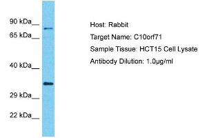 Host: Rabbit Target Name: C10orf71 Sample Type: HCT15 Whole cell lysates Antibody Dilution: 1. (C10ORF71 antibody  (C-Term))