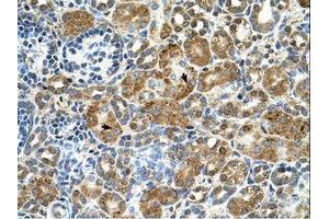 Image no. 1 for anti-Cystatin B (Stefin B) (CSTB) (C-Term) antibody (ABIN6738183) (CSTB antibody  (C-Term))