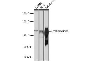 Western blot analysis of extracts of various cell lines, using p75NTR/NGFR antibody (ABIN7268850) at 1:1000 dilution. (NGFR antibody)