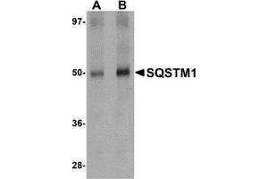 AP20066PU-N SQSTM1 antibody staining of Human Spleen Tissue Lysate by Western Blotting at (A) 1 and (B) 2 μg/ml. (SQSTM1 antibody  (C-Term))