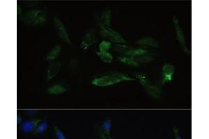 Immunofluorescence analysis of U2OS cells using TGFBR2 Polyclonal Antibody at dilution of 1:100. (TGFBR2 antibody)