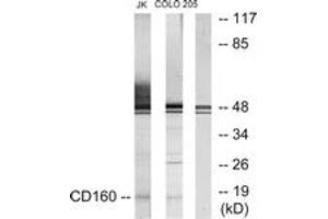 Western blot analysis of extracts from Jurkat/COLO205 cells, using CD160 Antibody. (CD160 antibody  (AA 21-70))