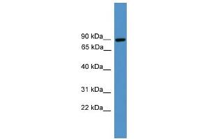 WB Suggested Anti-ZBED1 Antibody Titration:  0. (ZBED1 antibody  (C-Term))
