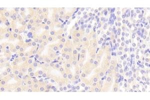 Detection of FADD in Mouse Kidney Tissue using Polyclonal Antibody to Fas Associating Death Domain Containing Protein (FADD) (FADD antibody  (AA 7-178))