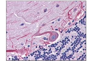 Human Brain, Cerebellum: Formalin-Fixed, Paraffin-Embedded (FFPE) (SKA1 antibody  (C-Term))