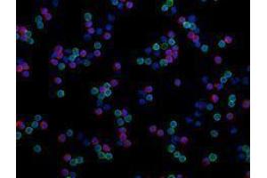 Immunofluorescence (IF) image for anti-CD8a Molecule (CD8A) antibody (Alexa Fluor 594) (ABIN2656837) (CD8 alpha antibody  (Alexa Fluor 594))