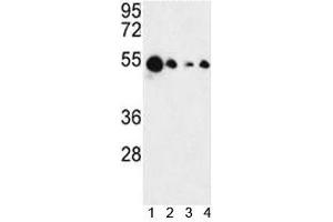 Western blot analysis of AIM2 antibody and 1) MCF-7, 2) HL-60, 3) K562 and 4) HeLa lysate.
