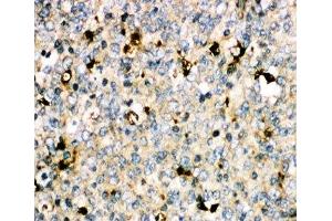 IHC-P: MyD88 antibody testing of human tonsil tissue (MYD88 antibody  (Middle Region))