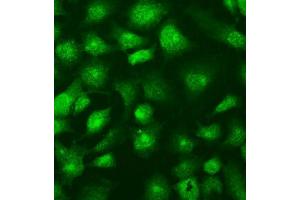 IF analysis of SUFU using anti-SUFU antibody (ABIN7601394). (SUFUH antibody  (AA 34-484))