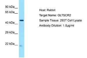 Host: RabbitTarget Name: GLTSCR2Antibody Dilution: 1. (GLTSCR2 antibody  (C-Term))