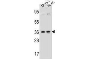 Western Blotting (WB) image for anti-Leucine Zipper Protein 2 (LUZP2) antibody (ABIN2997192) (LUZP2 antibody)