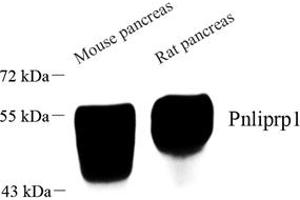 Western blot analysis of Pnliprp1 (ABIN7074981) at dilution of 1: 1000