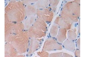 Detection of MYLK2 in Mouse Skeletal muscle Tissue using Polyclonal Antibody to Myosin Light Chain Kinase 2 (MYLK2) (MYLK2 antibody  (AA 330-548))