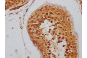 IHC image of ABIN7127796 diluted at 1:100 and staining in paraffin-embedded human testis tissue performed on a Leica BondTM system. (Recombinant RNF2 antibody)