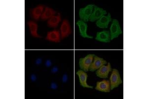 ABIN6260771 and ABIN6279279 staining Hela cells by IF/ICC. (CEP72 antibody  (Internal Region))