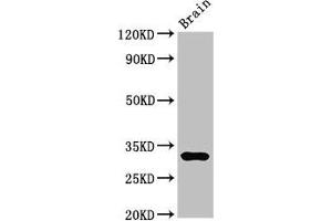Western Blot Positive WB detected in: Mouse brain tissue All lanes: DNASE1 antibody at 3 μg/mL Secondary Goat polyclonal to rabbit IgG at 1/50000 dilution Predicted band size: 32, 20 kDa Observed band size: 32 kDa (DNASE1 antibody  (AA 78-231))