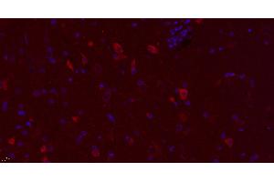 Paraformaldehyde-fixed, paraffin embedded rat brain, Antigen retrieval by boiling in sodium citrate buffer (pH6. (DRD3 antibody  (AA 352-446) (AbBy Fluor® 594))