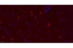 Paraformaldehyde-fixed, paraffin embedded rat brain, Antigen retrieval by boiling in sodium citrate buffer (pH6.