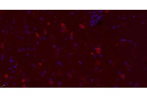Paraformaldehyde-fixed, paraffin embedded rat brain, Antigen retrieval by boiling in sodium citrate buffer (pH6. (DRD3 antibody  (AA 352-446) (Alexa Fluor 594))