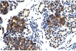 Human Pancreas; TRIM41 antibody - C-terminal region in Human Pancreas cells using Immunohistochemistry (TRIM41 antibody  (C-Term))