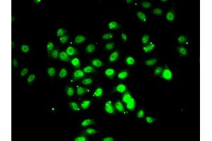 Immunofluorescence analysis of U2OS cells using RFX5 antibody (ABIN5974192). (RFX5 antibody)